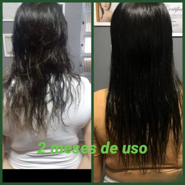 Biotin Shampoo Fortifying Treatment For Hair Growth And Anti Loss - Image 6