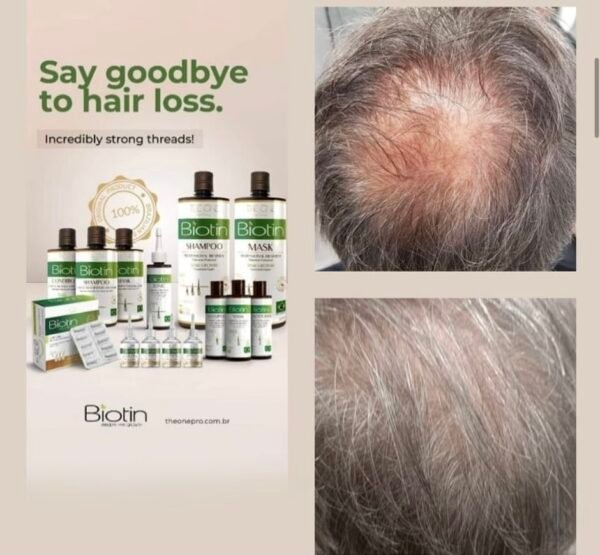 Biotin Shampoo Fortifying Treatment For Hair Growth And Anti Loss - Image 7