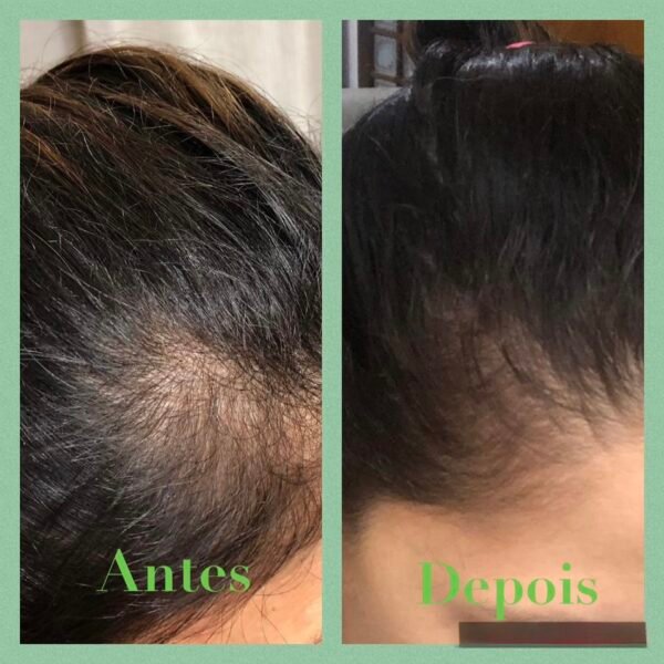 Biotin Shampoo Fortifying Treatment For Hair Growth And Anti Loss - Image 5